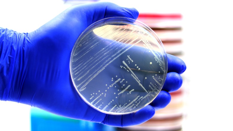 Listeria on an agar plate