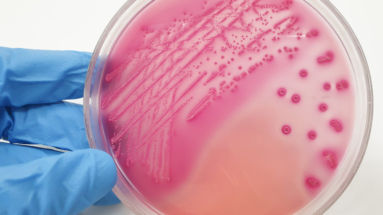 hand holding E coli colony on a glass plate