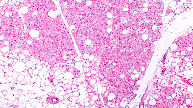 white and brown adipose tissue